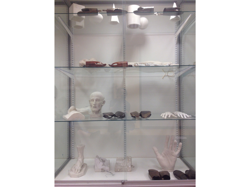 Eija Mustonen, Mittens in Exhibition (in anatomy glass case in 2015), 2014–2015, objects, copper, nickel silver, each 260 x 110 x 70 mm , photo: artist Eija Mustonen, Mittens in Exhibition (in anatomy glass case in 2015), 2014–2015, objects, copper, nickel silver, each 260 x 110 x 70 mm , photo: artist