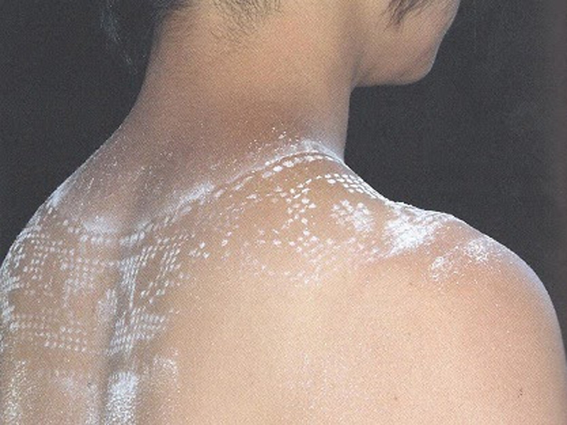 Millie Cullivan, Lace Collar, 2004, photograph, photo: Caroline Broadhead Millie Cullivan, Lace Collar,